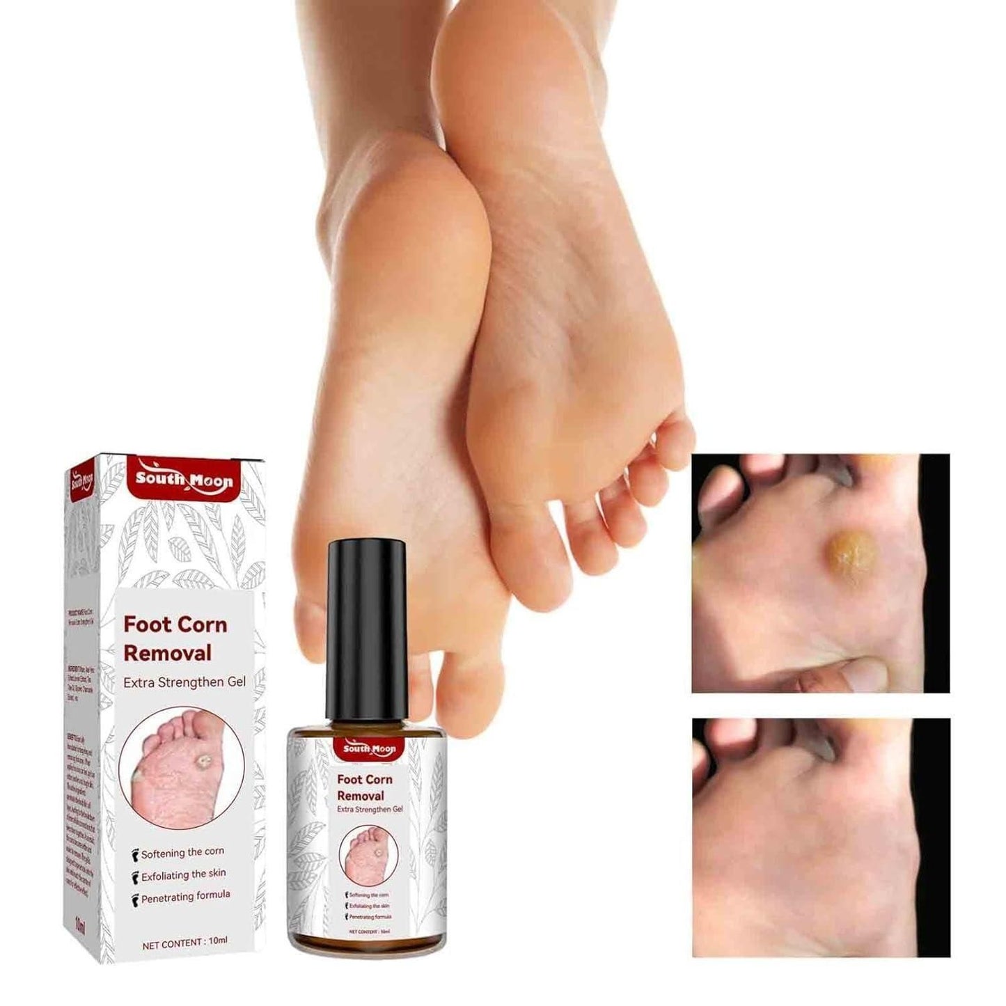 Feet Corn Removal Serum 30ml