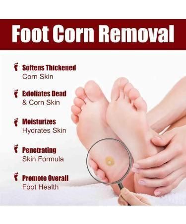 Feet Corn Removal Serum 30ml